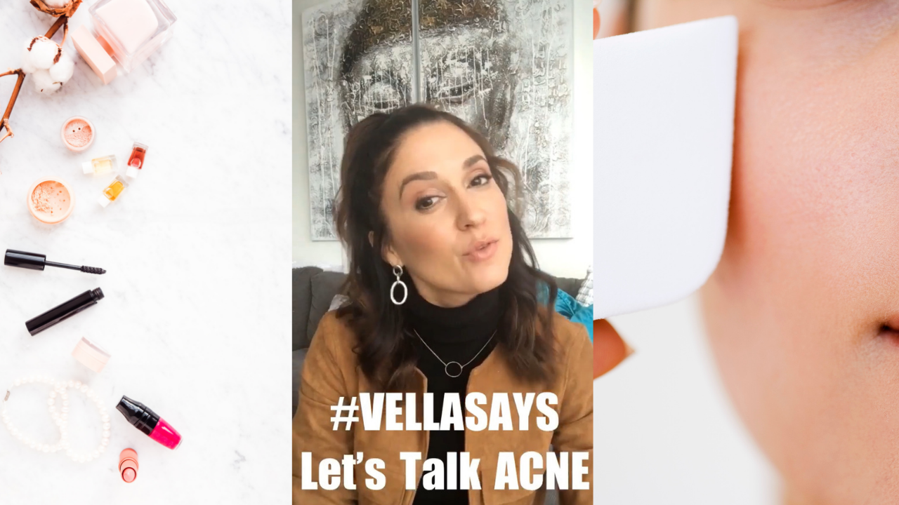 #VellaSays - Acne